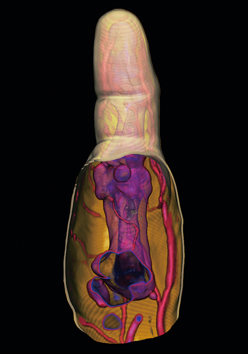 20161005_empathetic_05